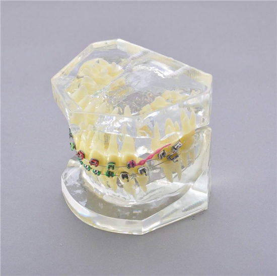 Dental Modelo M-3005 II tratamiento de solapamientos dentales